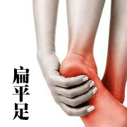 15年专家科普 脚疼 腿疼 腰疼  可能是扁平足导致
